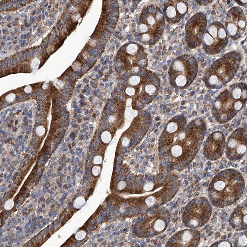 Immunohistochemical staining of human duodenum shows strong cytoplasmic positivity in glandular cells.