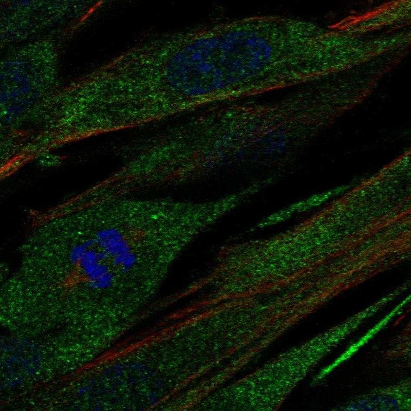 Immunofluorescent staining of human cell line ASC TERT1 shows localization to cytosol.