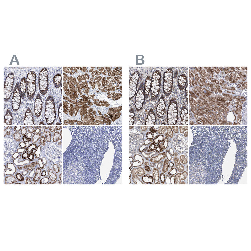 Immunohistochemistry analysis in human parathyroid gland and pancreas tissues using Anti-COQ3 antibody. Corresponding COQ3 RNA-seq data are presented for the same tissues.
