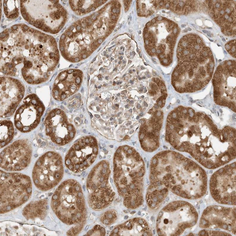 Immunohistochemical staining of human kidney shows strong cytoplasmic positivity in cells in tubules.