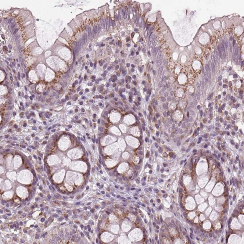Immunohistochemical staining of human colon shows moderate, granular cytoplasmic positivity in glandular cells.