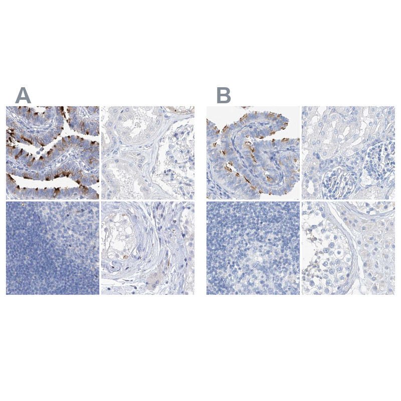 Immunohistochemical staining of human fallopian tube, kidney, lymph node and testis using Anti-C1orf87 antibody HPA031368 (A) shows similar protein distribution across tissues to independent antibody HPA031366 (B).