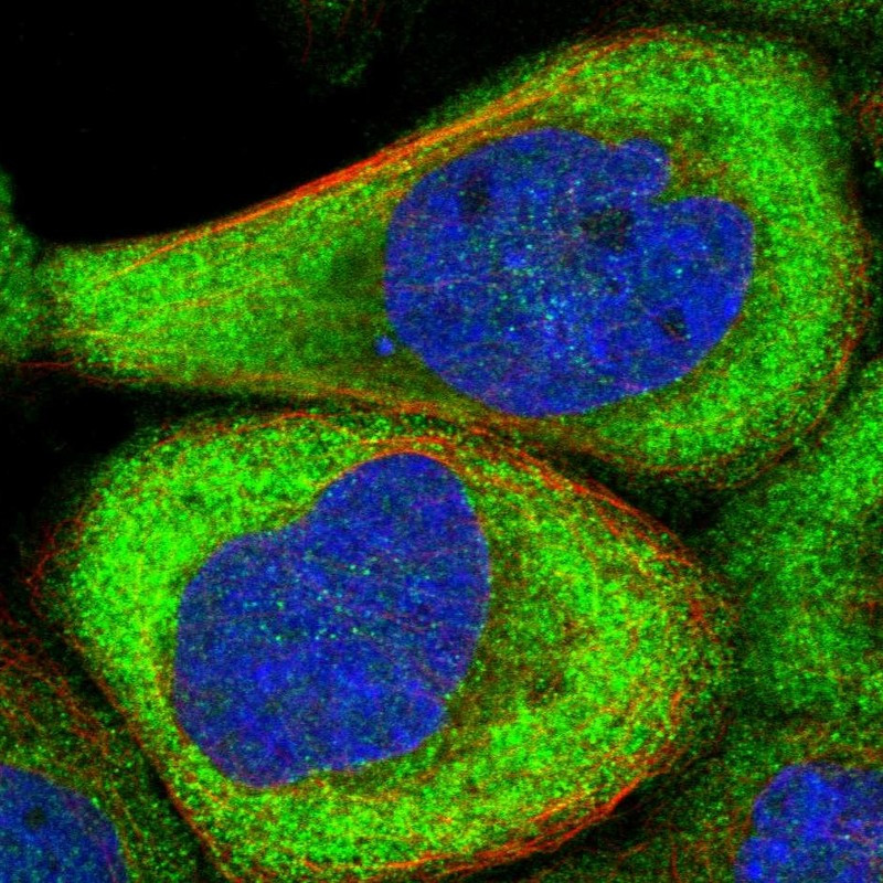 Immunofluorescent staining of human cell line A-431 shows localization to cytosol.