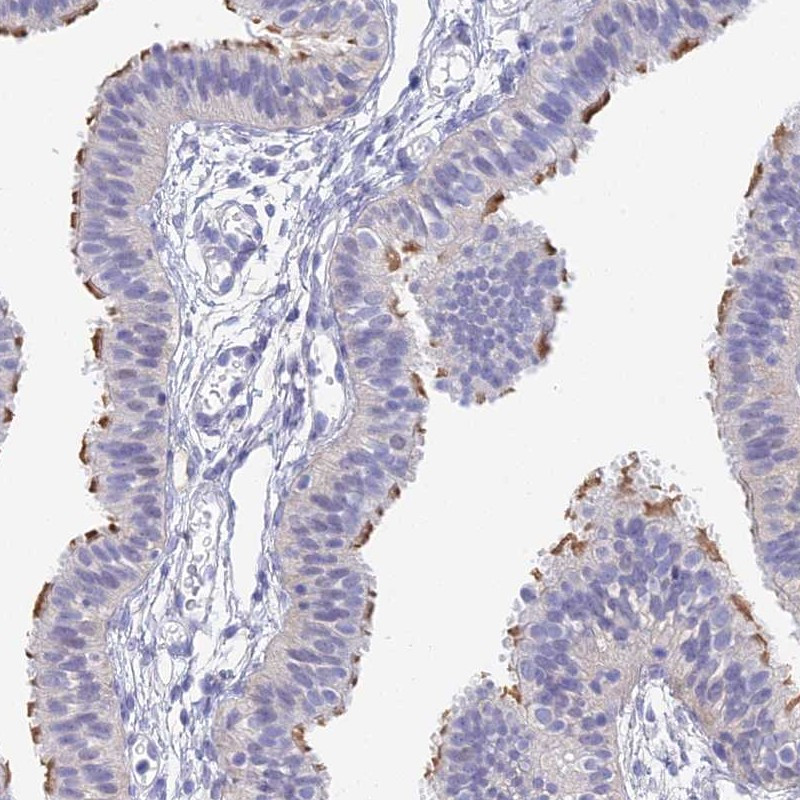 Immunohistochemical staining of human fallopian tube shows moderate positivity in cilia.