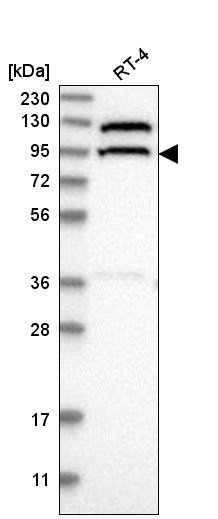 Western blot analysis in human cell line RT-4.