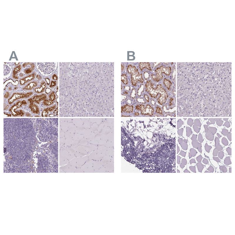 Immunohistochemical staining of human kidney, liver, lymph node and skeletal muscle using Anti-ATP6V1D antibody HPA031515 (A) shows similar protein distribution across tissues to independent antibody HPA057316 (B).