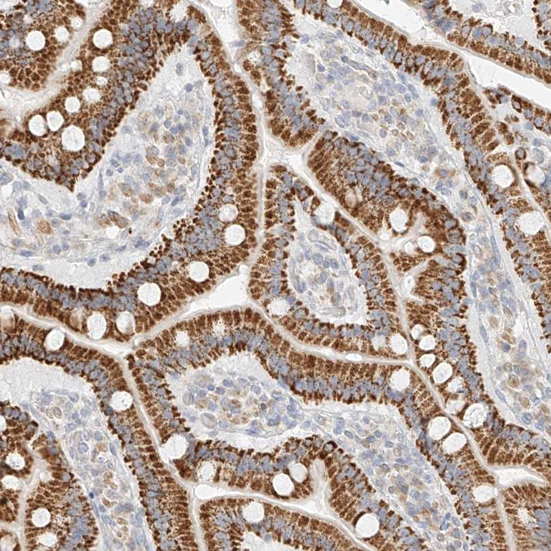 Immunohistochemical staining of human duodenum shows strong cytoplasmic positivity in glandular cells.