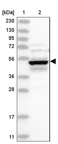 Lane 1: Marker [kDa] 230, 130, 95, 72, 56, 36, 28, 17, 11<br/>Lane 2: Human cell line RT-4