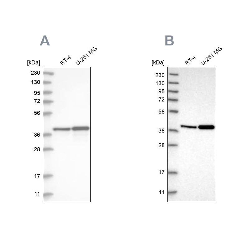 Western blot analysis using Anti-ECI2 antibody HPA031626 (A) shows similar pattern to independent antibody HPA022130 (B).