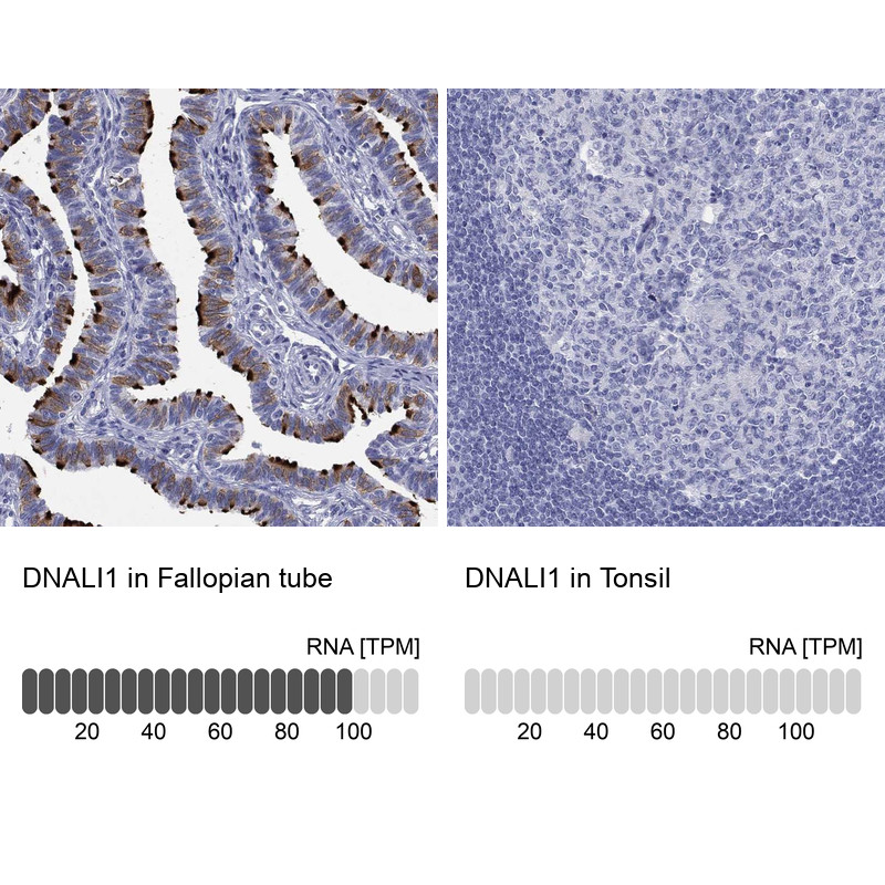 Immunohistochemistry analysis in human fallopian tube and tonsil tissues using Anti-DNALI1 antibody. Corresponding DNALI1 RNA-seq data are presented for the same tissues.
