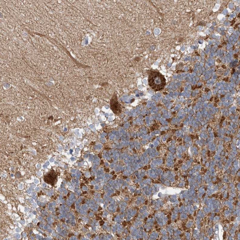 Immunohistochemical staining of human cerebellum shows strong cytoplasmic positivity in Purkinje cells and cells in granular layer.