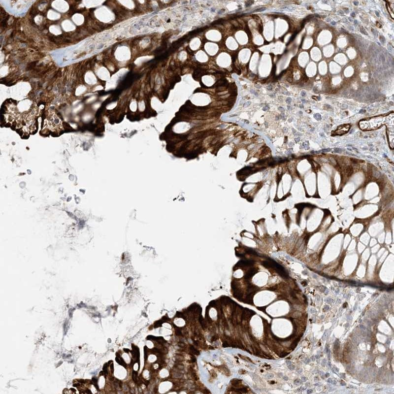 Immunohistochemical staining of human colon shows strong cytoplasmic and membranous positivity in glandular cells.
