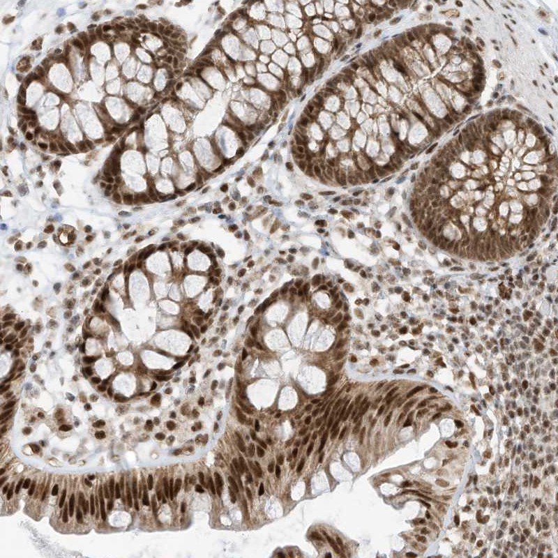Immunohistochemical staining of human colon shows strong nuclear and cytoplasmic positivity in glandular cells.