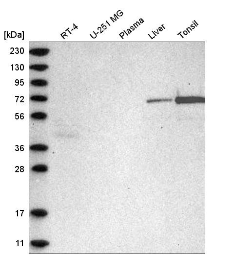 Western blot analysis in human cell line RT-4, human cell line U-251 MG, human plasma, human liver tissue and human tonsil tissue.