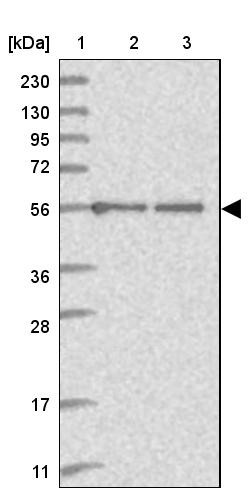 Lane 1: Marker [kDa] 230, 130, 95, 72, 56, 36, 28, 17, 11<br/>Lane 2: Human cell line RT-4<br/>Lane 3: Human cell line U-251MG sp
