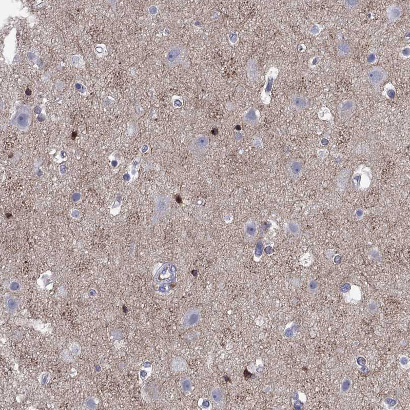 Immunohistochemistry analysis in human cerebral cortex and pancreas tissues using Anti-CNTNAP4 antibody. Corresponding CNTNAP4 RNA-seq data are presented for the same tissues.