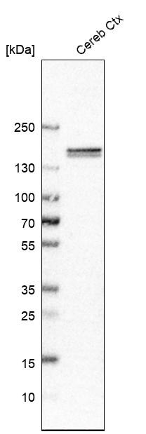 Western blot analysis in human cerebral cortex tissue.