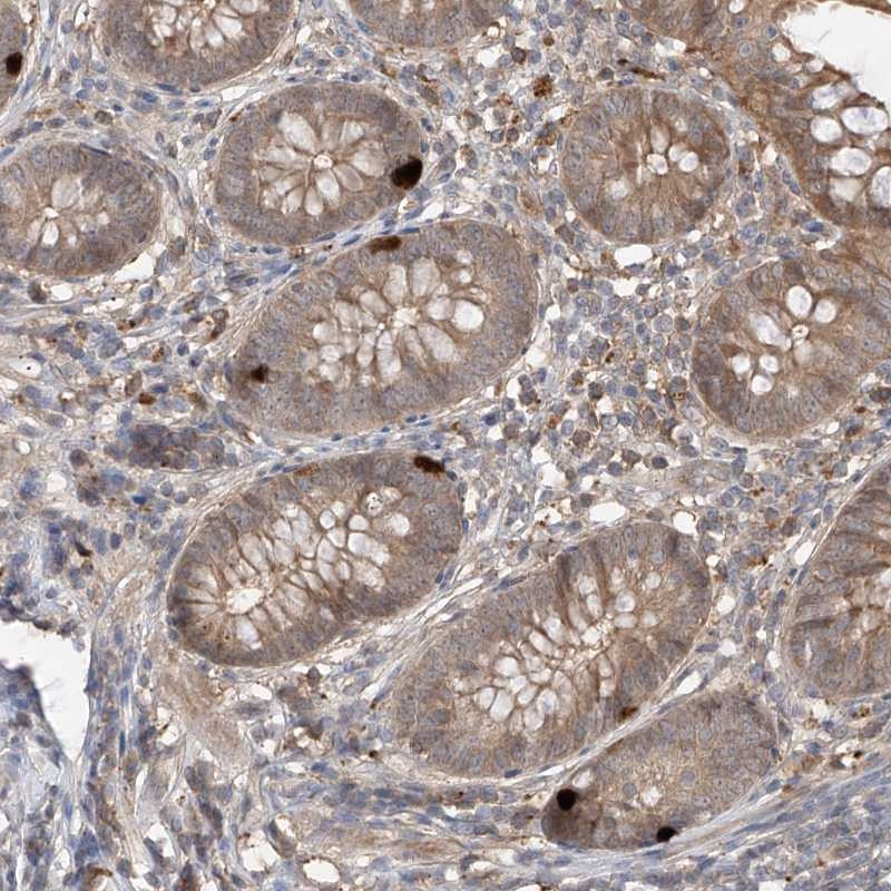 Immunohistochemical staining of human appendix shows strong positivity in a subset of glandular cells.