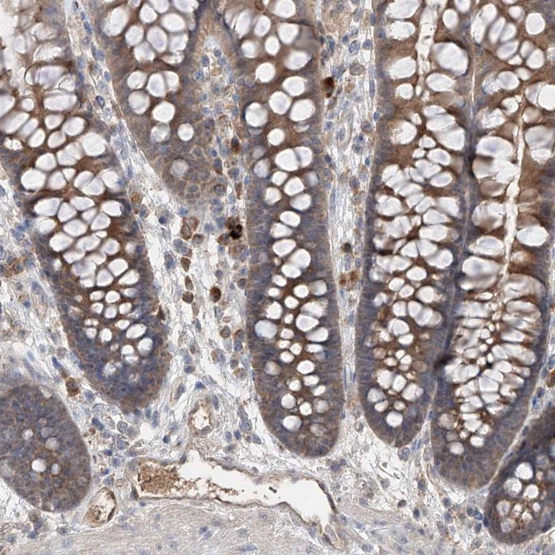 Immunohistochemical staining of human colon shows moderate cytoplasmic positivity in glandular cells and endothelial cells.