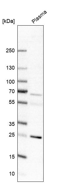 Western blot analysis in human plasma.