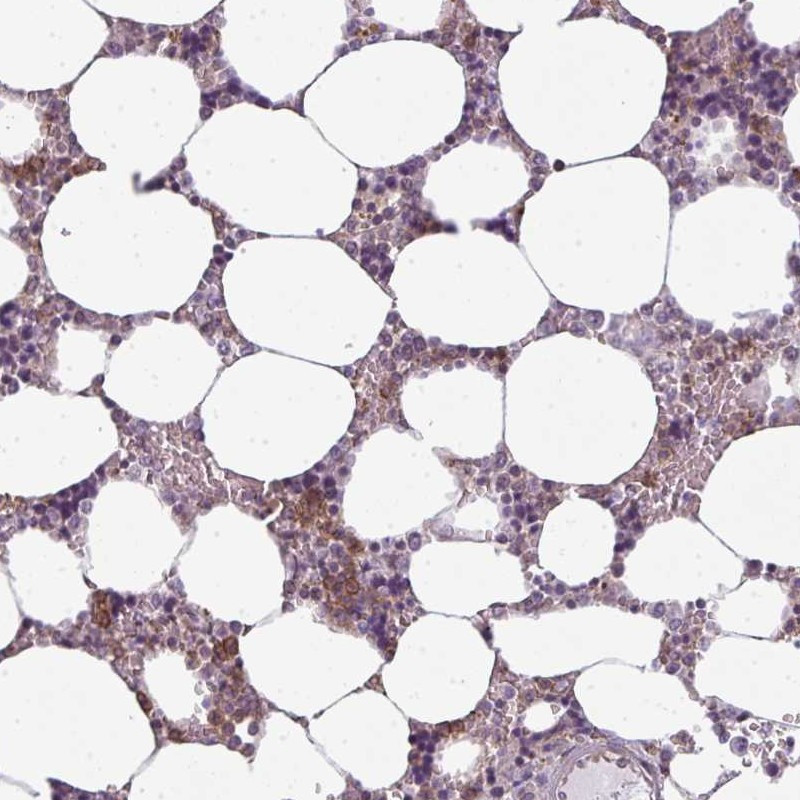 Immunohistochemical staining of human bone marrow shows positivity in hematopoietic cells.