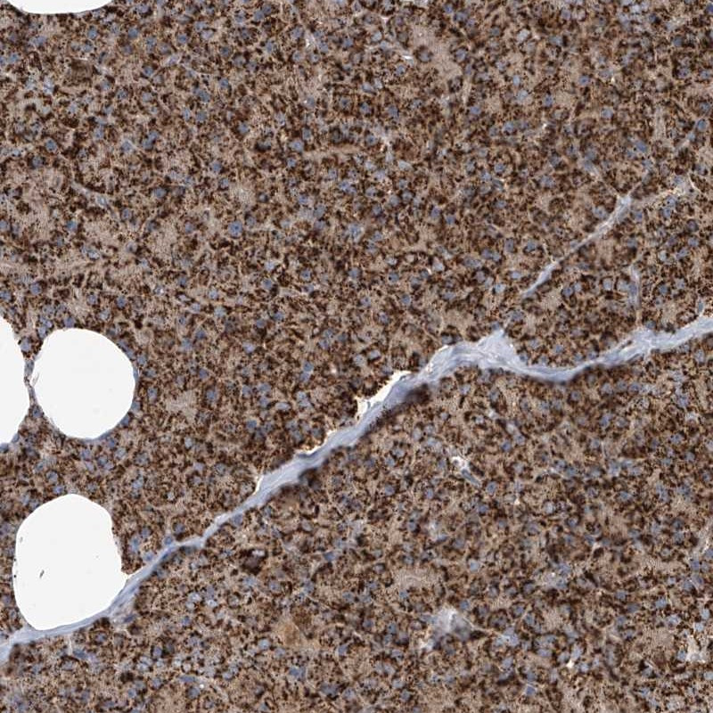 Immunohistochemical staining of human pancreas shows strong granular cytoplasmic positivity in exocrine glandular cells.