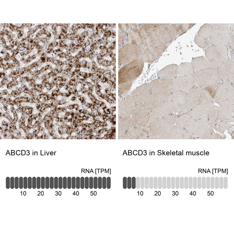 Immunohistochemistry analysis in human liver and skeletal muscle tissues using HPA032026 antibody. Corresponding ABCD3 RNA-seq data are presented for the same tissues.