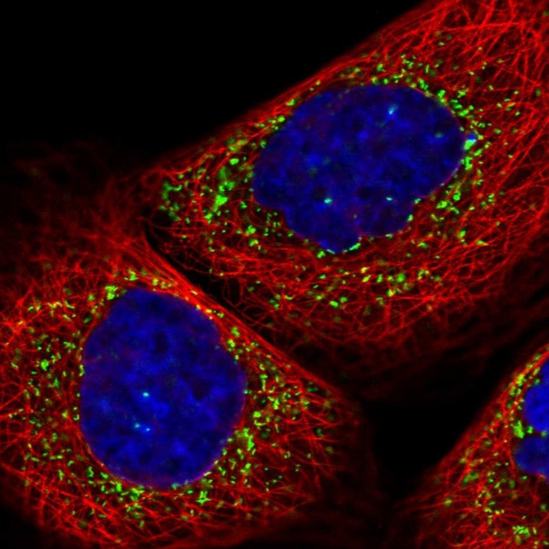 Immunofluorescent staining of human cell line A-431 shows localization to vesicles.
