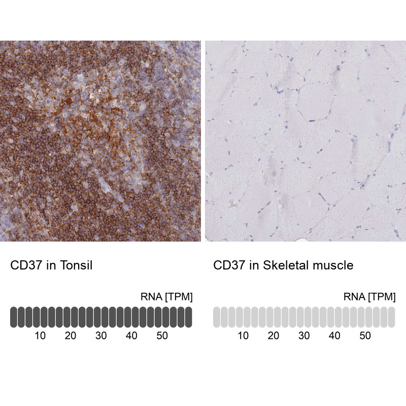 Immunohistochemistry analysis in human tonsil and skeletal muscle tissues using HPA032121 antibody. Corresponding CD37 RNA-seq data are presented for the same tissues.