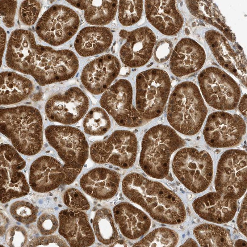 Immunohistochemical staining of human kidney shows strong cytoplasmic and nuclear positivity in renal tubules.
