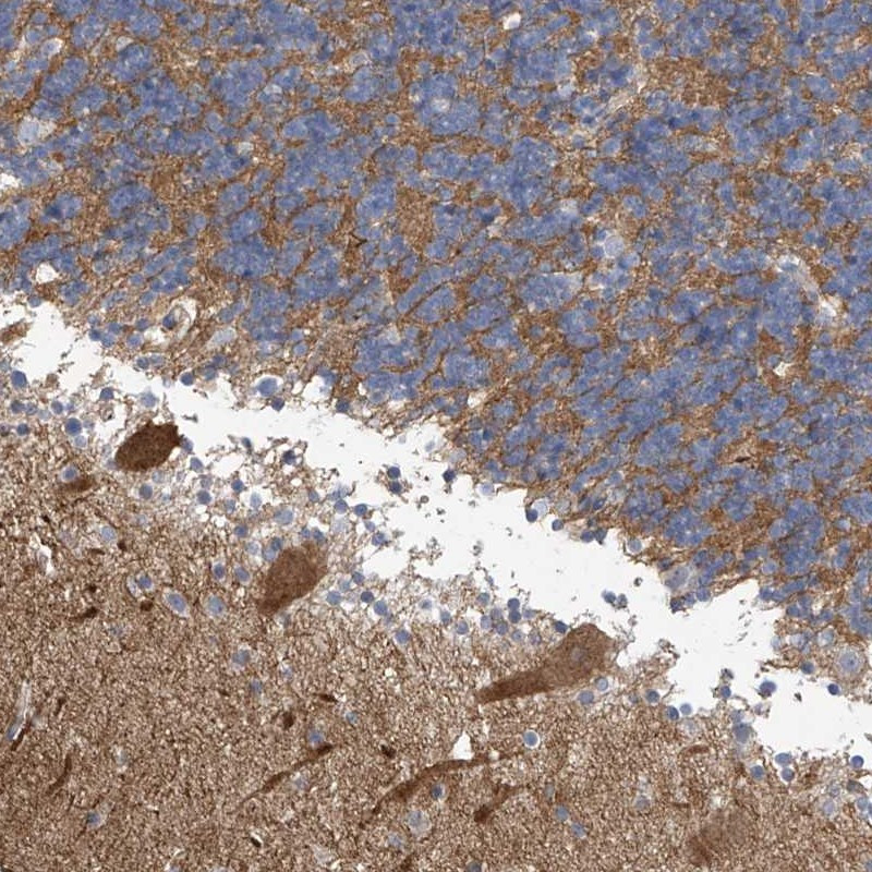 Immunohistochemical staining of human cerebellum shows distinct cytoplasmic positivity in Purkinje cells.