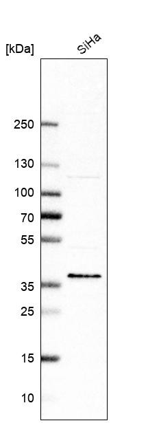 Western blot analysis in human cell line SiHa.