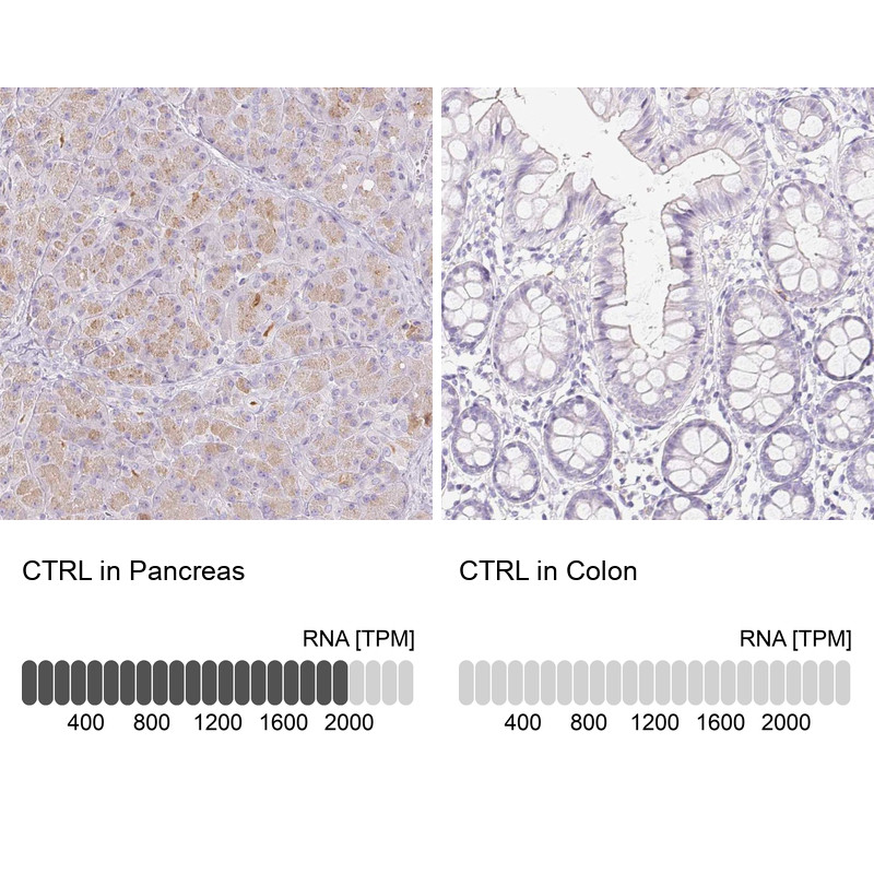 Immunohistochemistry analysis in human pancreas and colon tissues using Anti-CTRL antibody. Corresponding CTRL RNA-seq data are presented for the same tissues.
