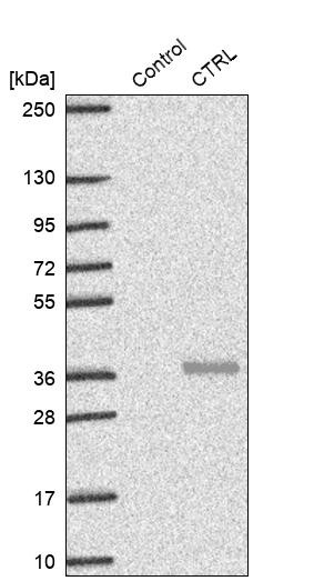 Western blot analysis in control (vector only transfected HEK293T lysate) and CTRL over-expression lysate (Co-expressed with a C-terminal myc-DDK tag (~3.1 kDa) in mammalian HEK293T cells, LY419665).
