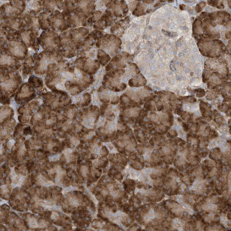 Immunohistochemical staining of human pancreas shows strong cytoplasmic positivity in exocrine glandular cells.