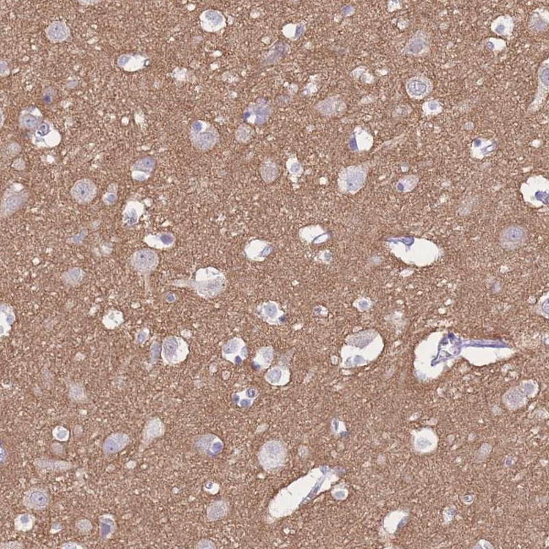 Immunohistochemical staining of human cerebral cortex shows distinct positivity in neuropil.