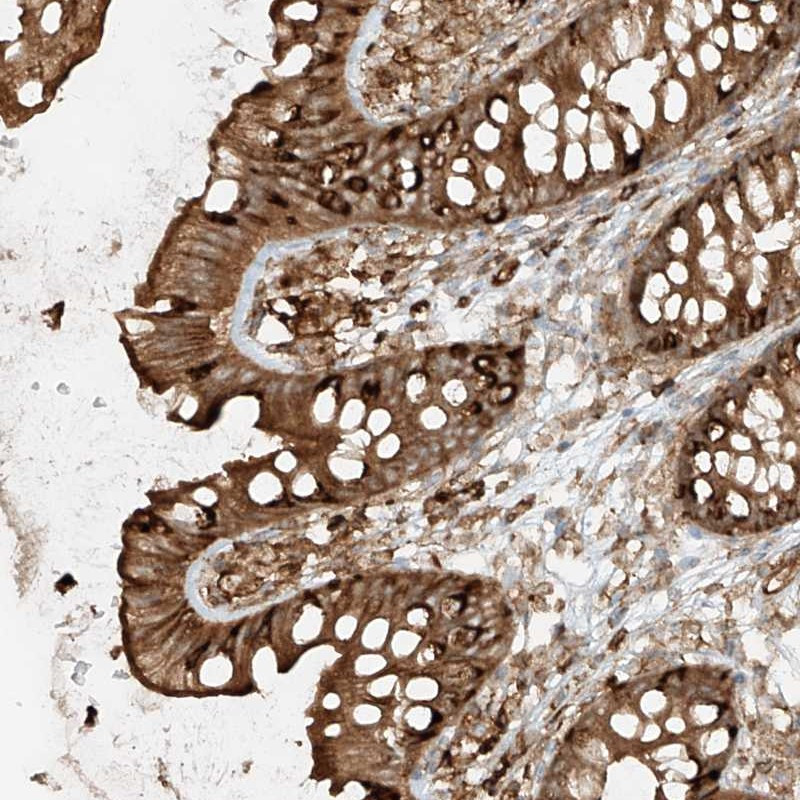 Immunohistochemical staining of human colon shows strong cytoplasmic positivity in glandular cells.