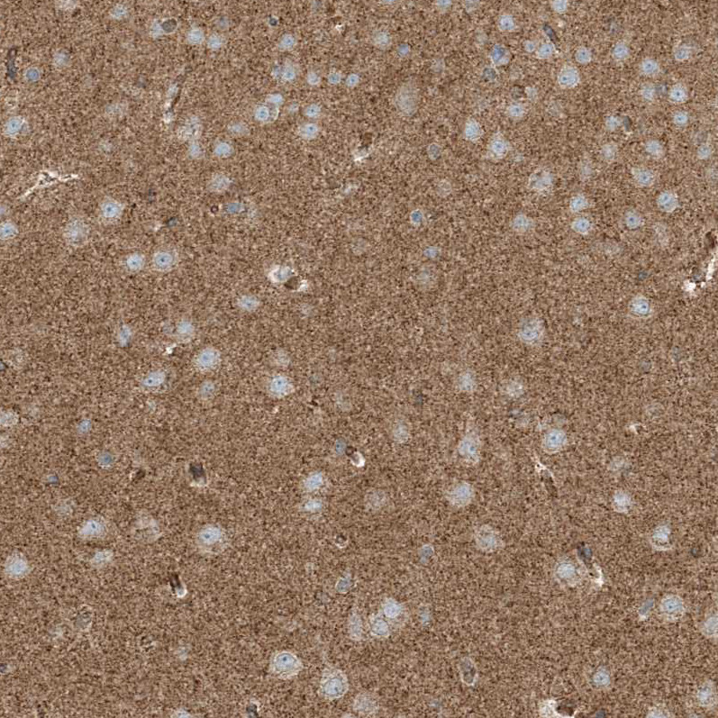 Immunohistochemical staining of human kidney shows strong cytoplasmic positivity in tubular cells.
