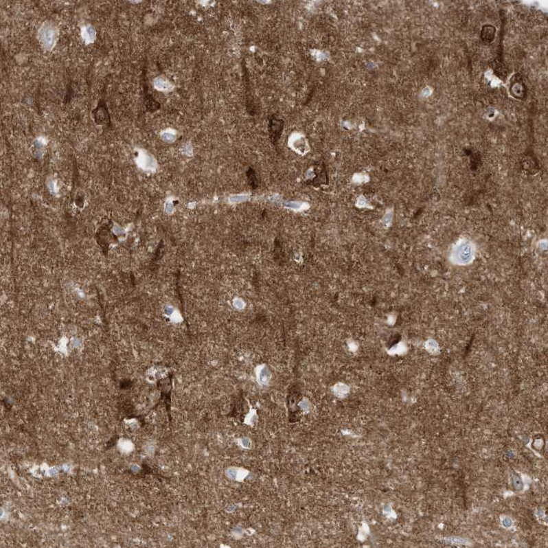 Immunohistochemical staining of human cerebral cortex shows strong cytoplasmic positivity in neurons.