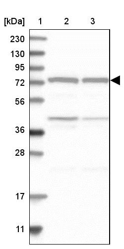 Lane 1: Marker [kDa] 230, 130, 95, 72, 56, 36, 28, 17, 11<br/>Lane 2: Human cell line RT-4<br/>Lane 3: Human cell line U-251MG sp