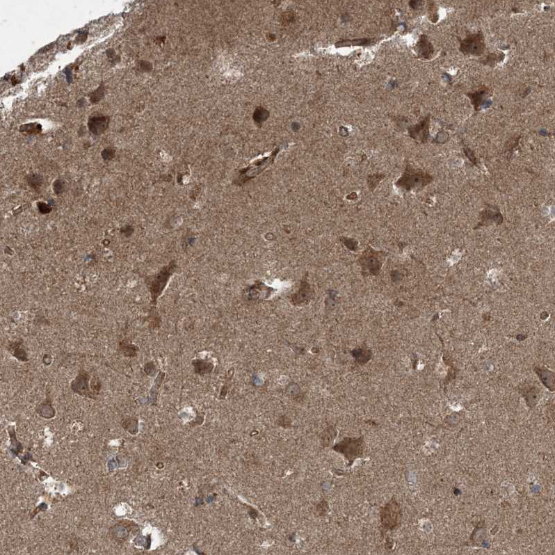Immunohistochemical staining of human cerebral cortex shows strong cytoplasmic positivity in neurons.