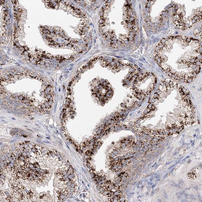 Immunohistochemical staining of human prostate shows strong granular cytoplasmic positivity in glandular cells.