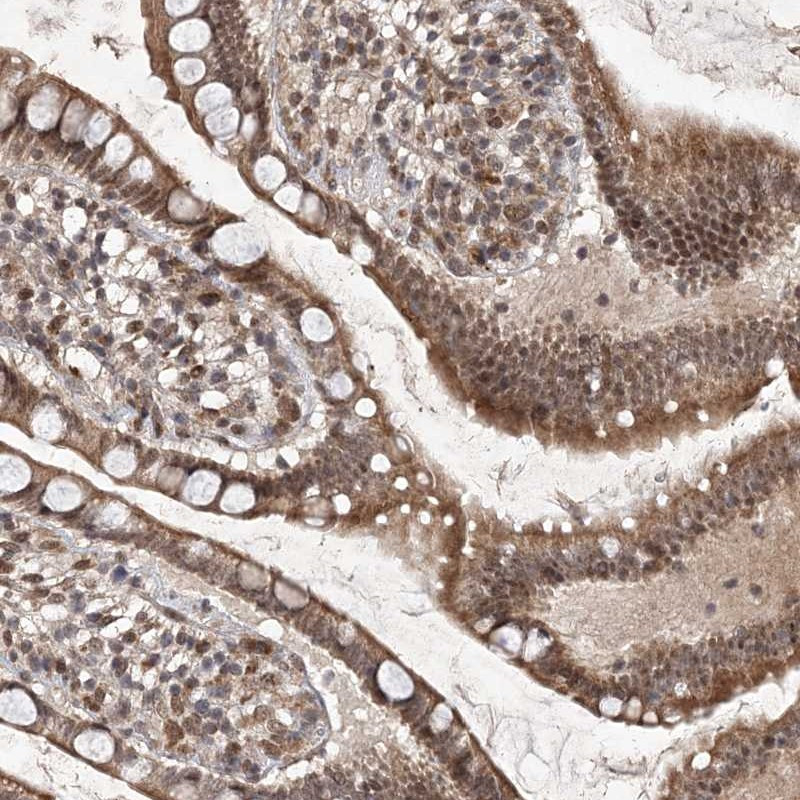 Immunohistochemical staining of human small intestine shows moderate cytoplasmic and nuclear positivity in glandular cells.