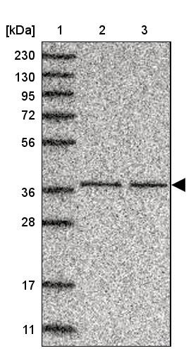 Lane 1: Marker [kDa] 230, 130, 95, 72, 56, 36, 28, 17, 11<br/>Lane 2: Human cell line RT-4<br/>Lane 3: Human cell line U-251MG sp