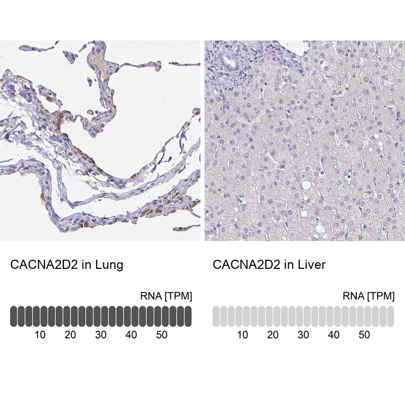 Immunohistochemistry analysis in human lung and liver tissues using HPA034771 antibody. Corresponding CACNA2D2 RNA-seq data are presented for the same tissues.