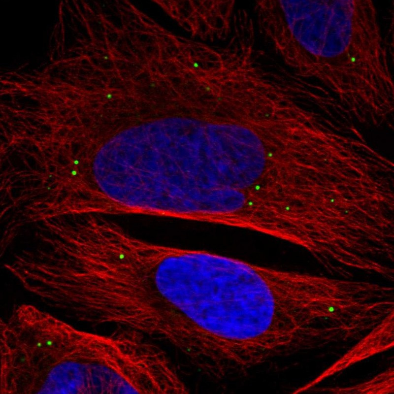 Immunofluorescent staining of human cell line U-2 OS shows localization to vesicles.