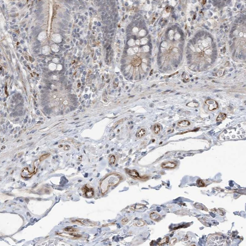 Immunohistochemical staining of human small intestine shows cytoplasmic positivity of endothelial cells.