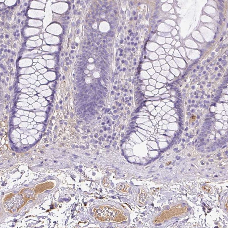 Immunohistochemical staining of human colon shows distinct plasma positivity.