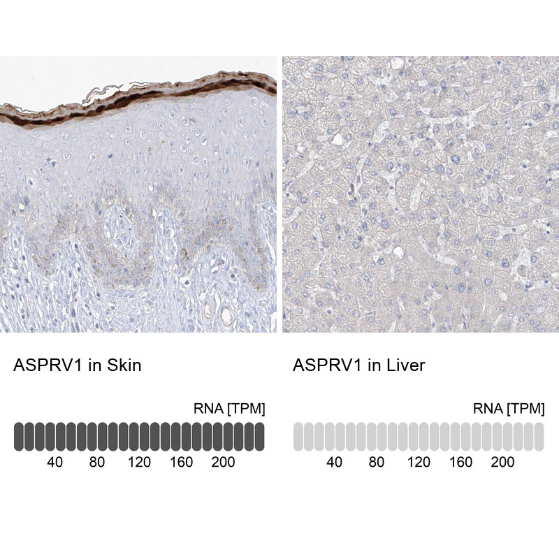 Immunohistochemistry analysis in human skin and liver tissues using HPA034810 antibody. Corresponding ASPRV1 RNA-seq data are presented for the same tissues.