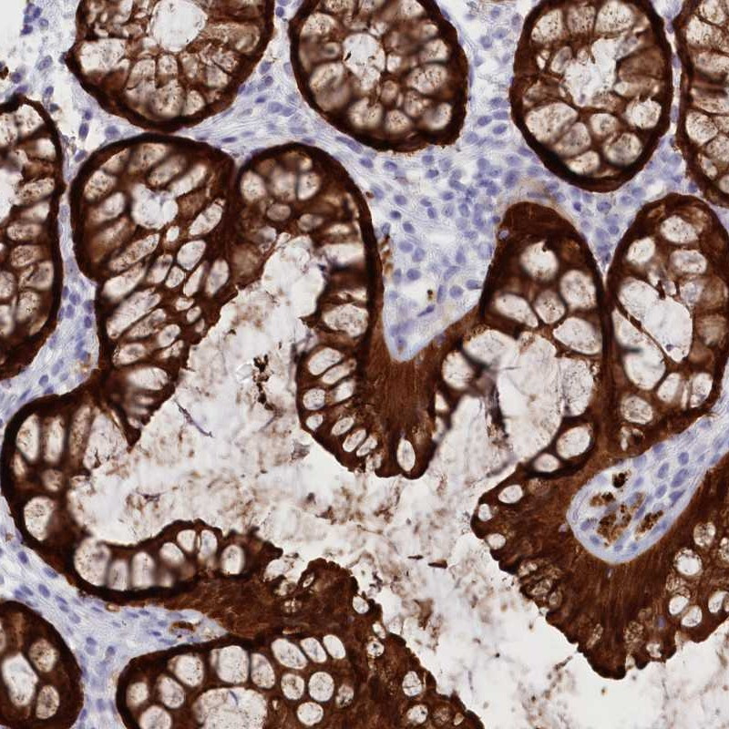 Immunohistochemical staining of human colon shows strong cytoplasmic positivity in glandular cells.
